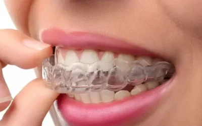 Gece Plağı Nasıl Kullanılır?